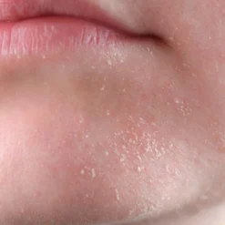 5 Jabón Natural Miel Y Propóleo. Ideal Para Higiene De Zona Íntima. Para Piel Sensible, Seca Y Apagada. Mejora El Acné