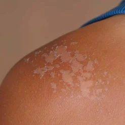 Pack 10 Jabón Natural De Caléndula - Calma La Piel Seca, Con Dermatitis E Irritaciones - Cicatriza Y Alivia Quemaduras
