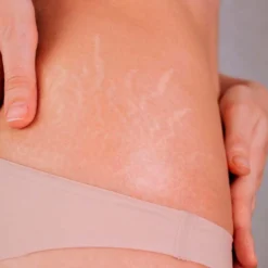 Pack 10 Jabón Natural Rosa Mosqueta. Para Todo Tipo De Piel. Hidrata Y Regenera Pieles Con Estrías, Manchas, Cicatrices